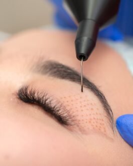 Blefaroplastia sin Cirugía (120 a 150m)